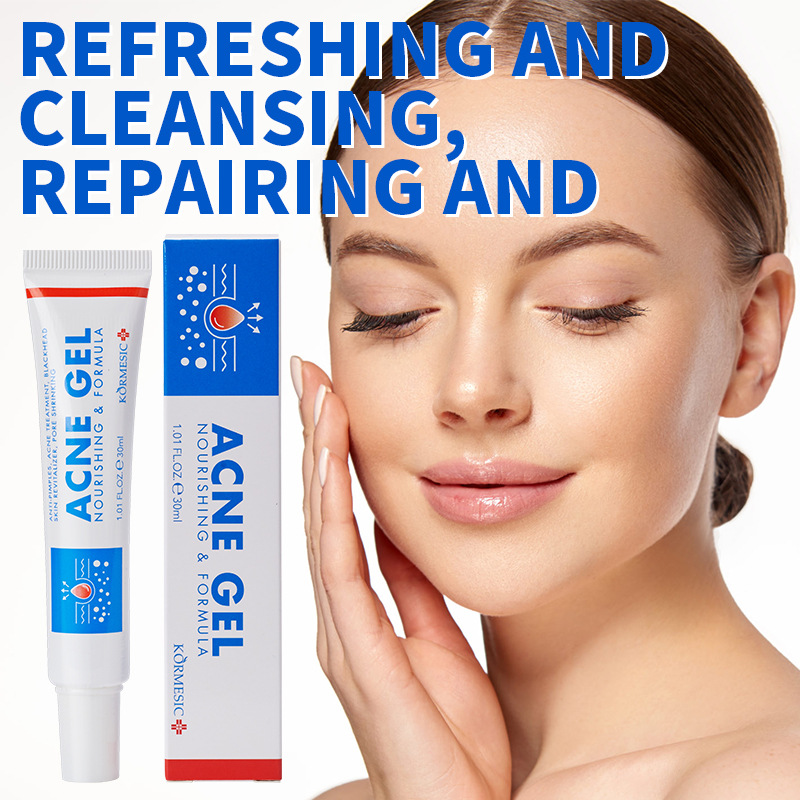 Face Moisturizer - เจลกำจัดสิว 30 กรัม ทำความสะอาดล้ำลึก ครีมลดสิว