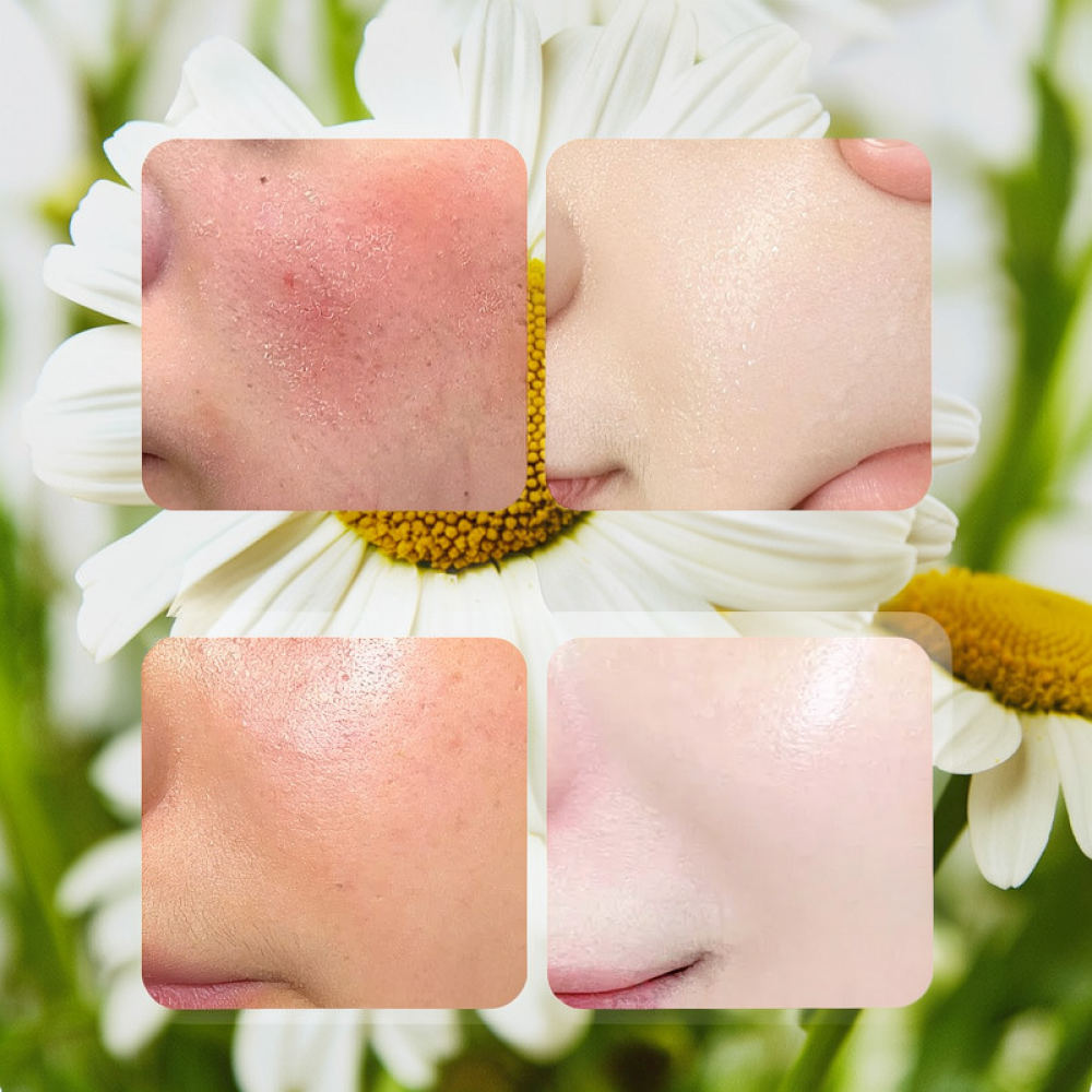 สำหรับมาสก์หน้าชนิดแผ่น Fykly  - Face Mask Skincare บทวิจารณ์และราคา