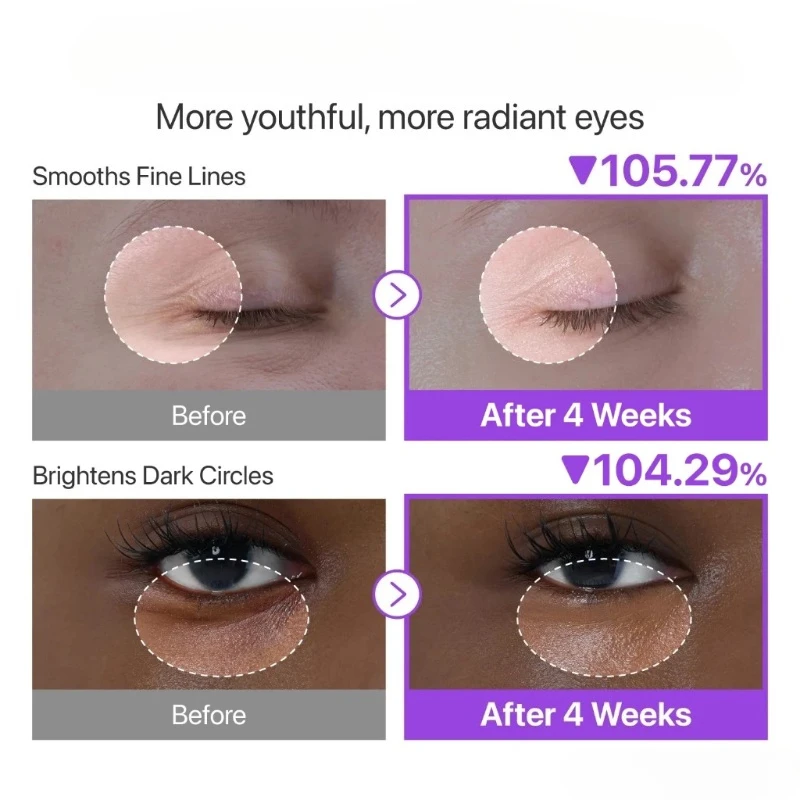ผลิตภัณฑ์บำรุงผิวหน้าและรอบดวง - Retinol Cream บทวิจารณ์และราคา
